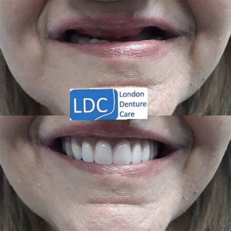London Denture Care